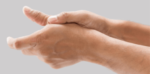 thumb sprain